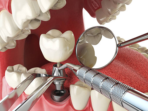 Best Emergency Treatment for Oral Infections in Rock Falls, IL